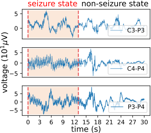 EEG signal sample visualization with epileptic seizure state in highlighted time range annotated by human experts.